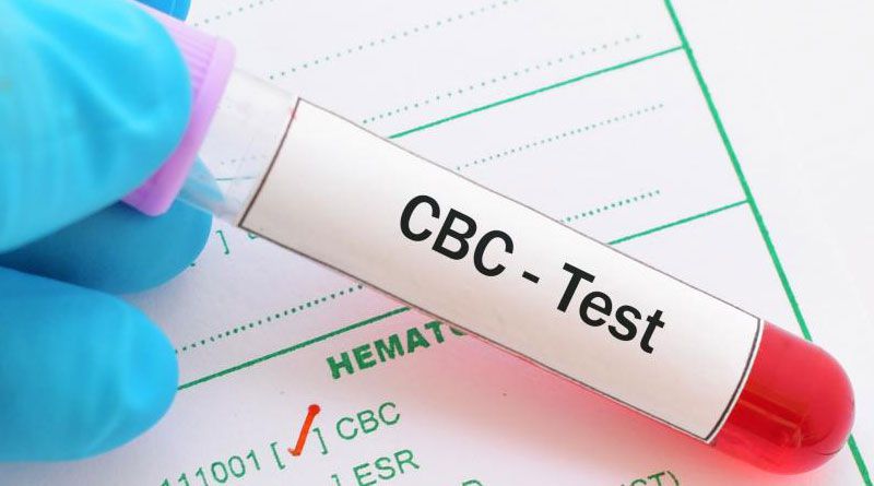 CBC Blood Test